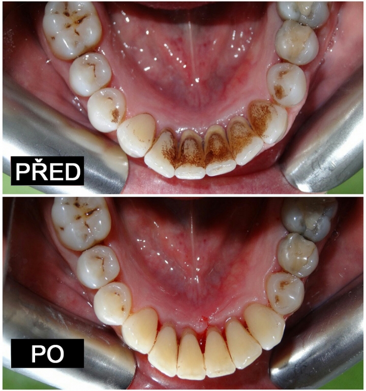 Přijmeme dentální hygienistku Přijmeme dentální hygienistku