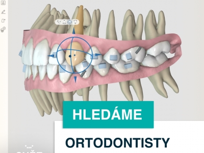 ORTODONTISTA/KA - komplexní zaučení do systému Invisalign